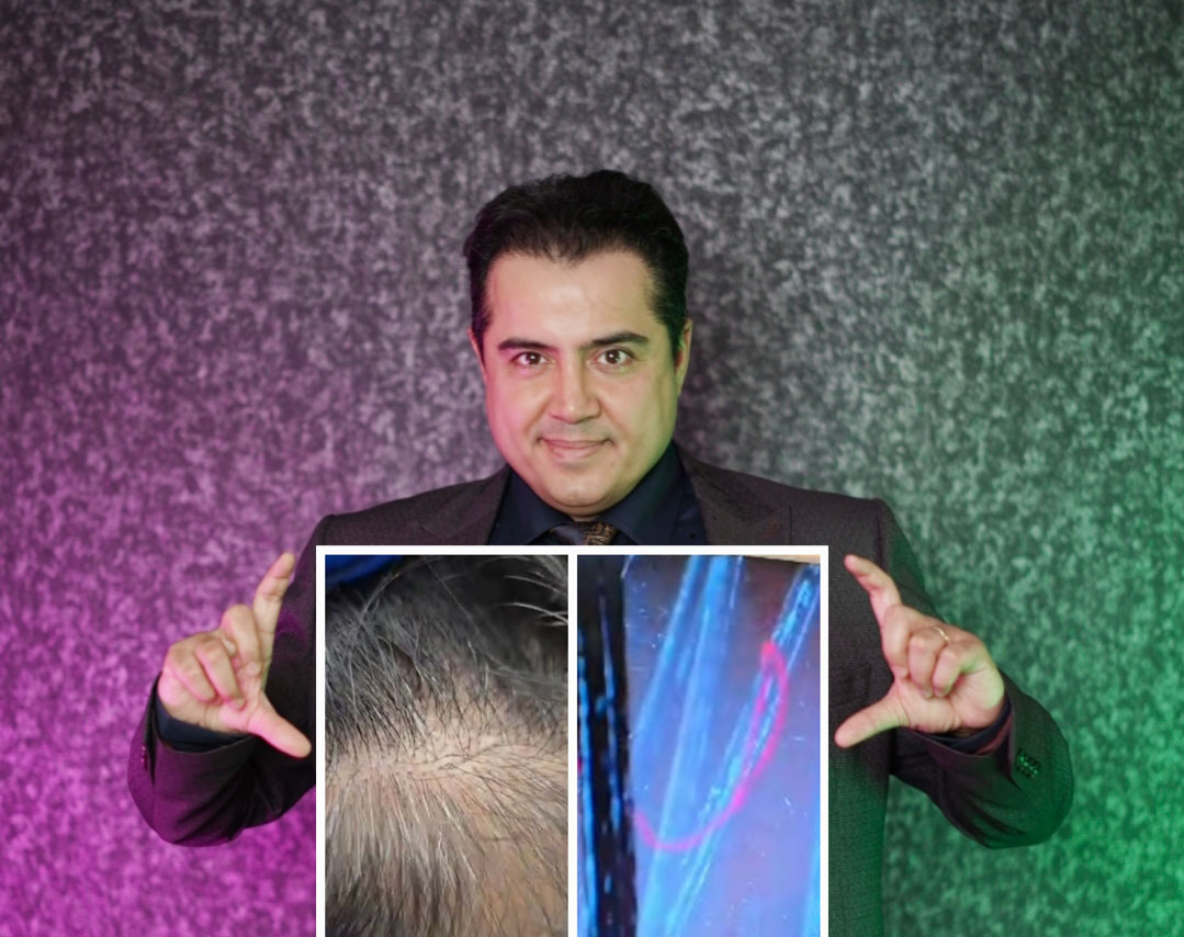 توهم استاف